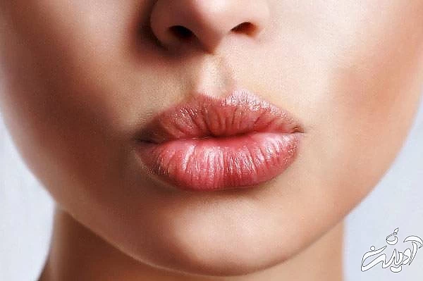 روش حجم دادن به لب ها برجسته کردن لبها